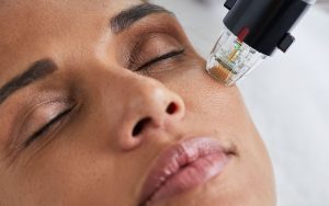 Lire la suite à propos de l’article L’art de la régénération cutanée, le microneedling radiofréquence selon Maison Lutétia