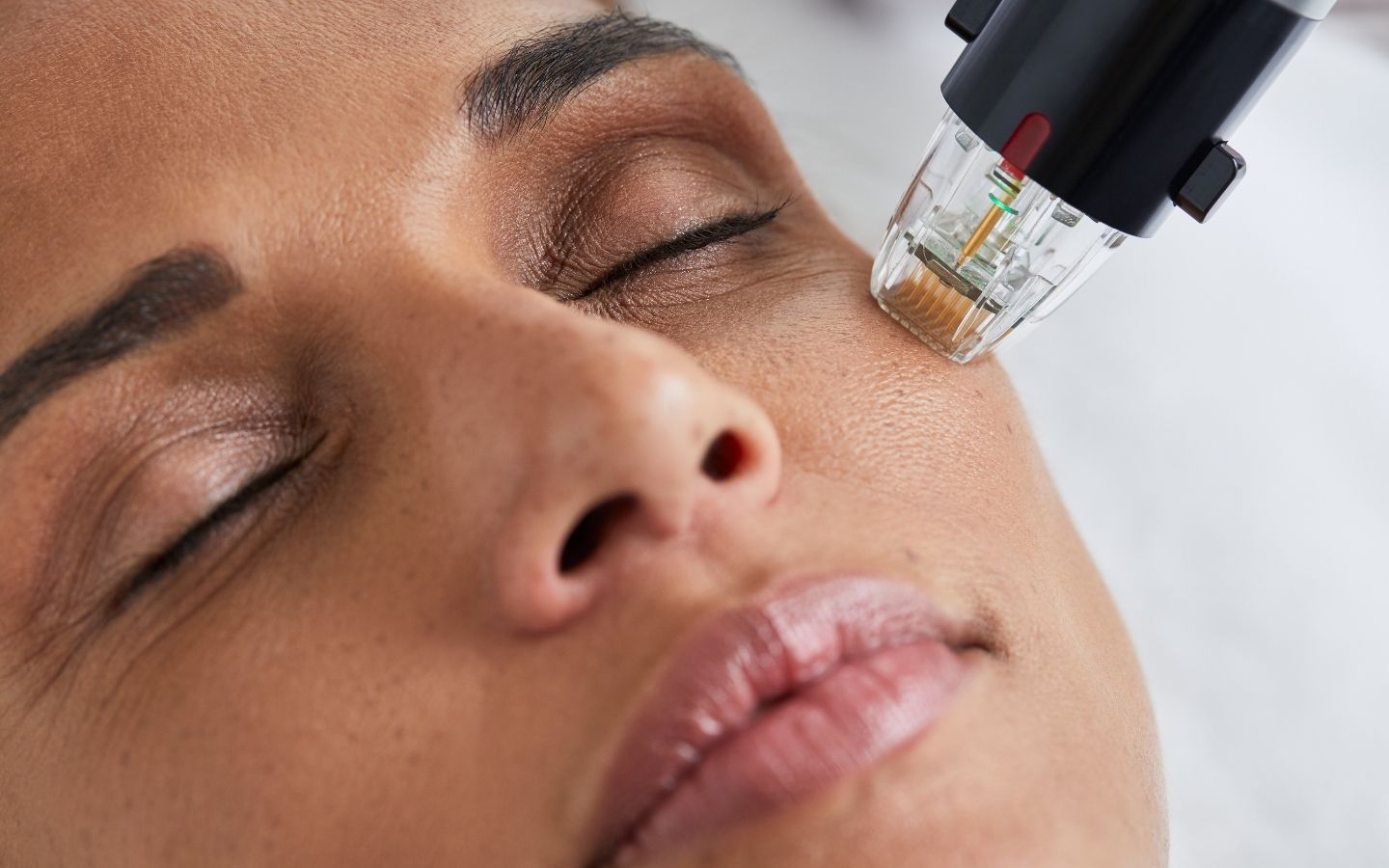 Lire la suite à propos de l’article L’art de la régénération cutanée, le microneedling radiofréquence selon Maison Lutétia